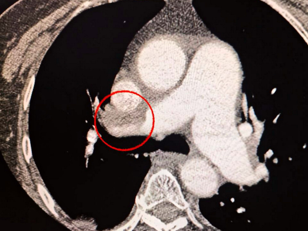 8901 image for slide